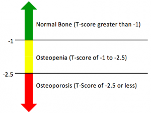 Strong and Stable | Osteopenia, Osteoporosis and Exercise